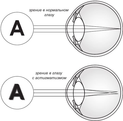 Близорукость рисунок физика