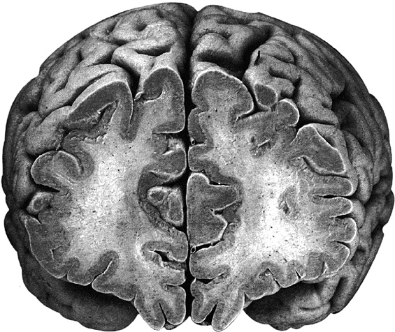 Головной мозг бехтерева. Нейрофизиология мозга Бехтерева. Мозг Бехтерева.
