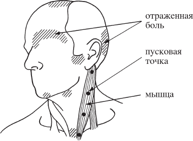 Клэр дэвис триггерные